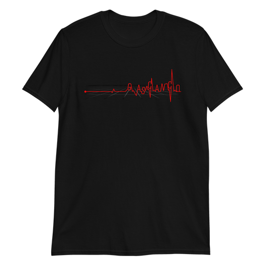 EKG SS TEE